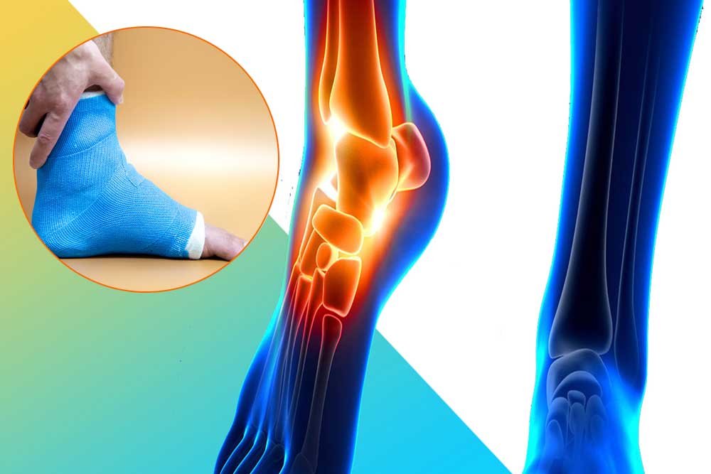 Orthotics