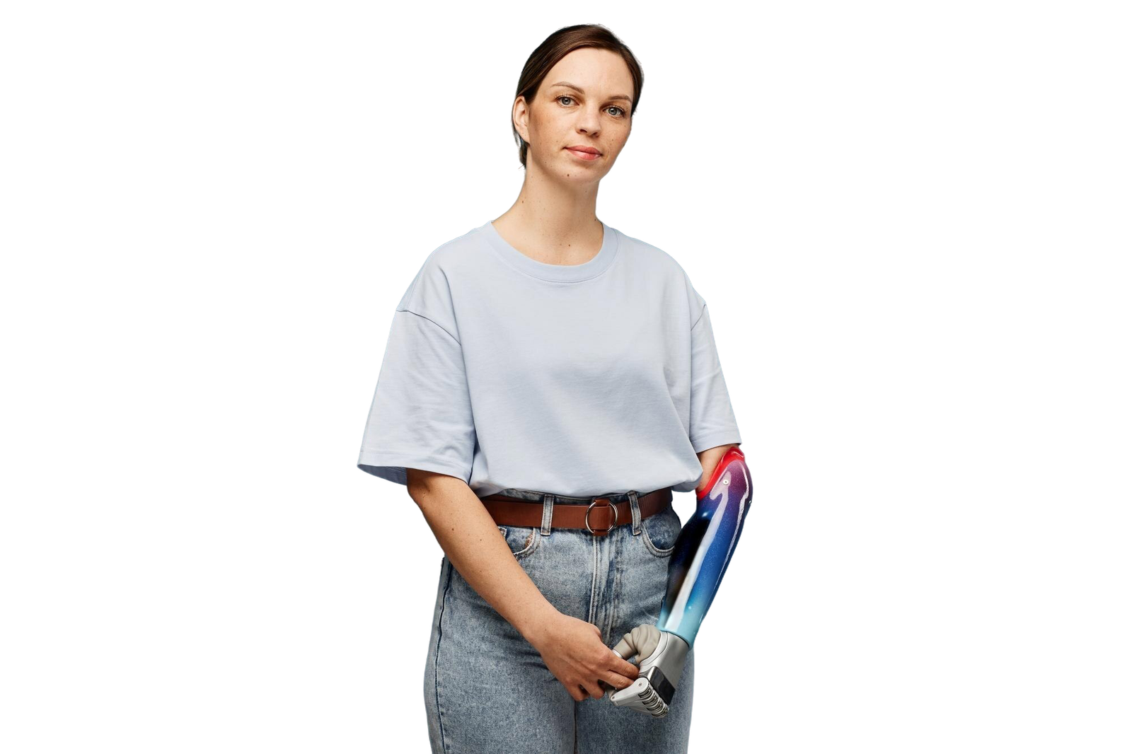 unsmiling-woman-with-prosthetic-arm