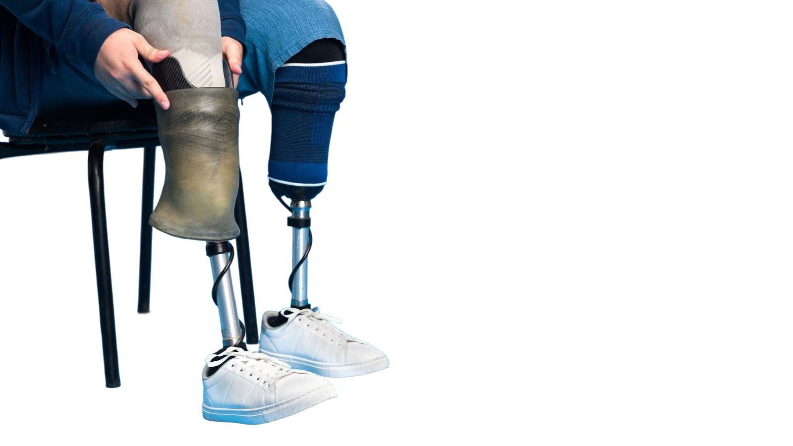 view-man-with-prosthetic-legs-white-sneakers-removing-prosthesis (1)