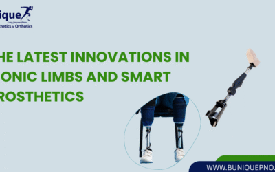 The Latest Innovations in Bionic Limbs and Smart Prosthetics