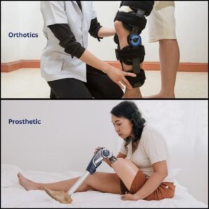 About Prosthetics and Orthotics